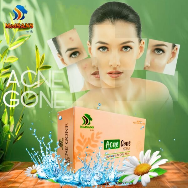 Acne Gone For Acne & Oily Skin